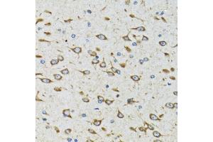 Immunohistochemistry of paraffin-embedded rat brain using AKTIP antibody (ABIN6131091, ABIN6136746, ABIN6136748 and ABIN6221837) at dilution of 1:100 (40x lens). (AKTIP anticorps  (AA 1-292))