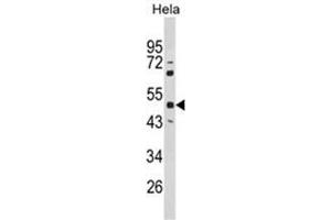 Western blot analysis of PAX6 Antibody (Center) in Hela cell line lysates (35ug/lane). (PAX6 anticorps  (Middle Region))
