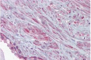 Immunohistochemistry with Prostate tissue at an antibody concentration of 5µg/ml using anti-KCNMA1 antibody (ARP35092_P050)