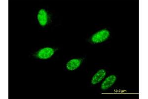 Immunofluorescence of monoclonal antibody to GBX2 on HeLa cell. (GBX2 anticorps  (AA 114-182))