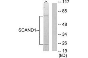 Western blot analysis of extracts from Jurkat cells, using SCAND1 Antibody.