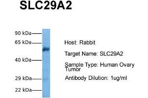 Host: Rabbit Target Name: SLC29A2 Sample Tissue: Human Ovary Tumor Antibody Dilution: 1. (SLC29A2 anticorps  (C-Term))