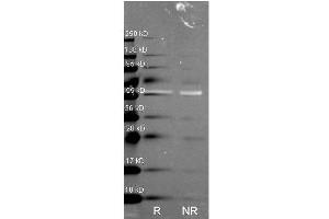 Western Blot of Rabbit anti-Catalase antibody. (Catalase anticorps)