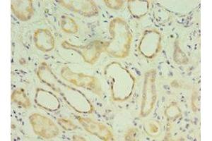 Immunohistochemistry of paraffin-embedded human kidney tissue using ABIN7159049 at dilution of 1:100 (Matrilin 3 anticorps  (AA 277-486))
