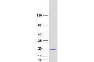 S-Phase Kinase-Associated Protein 1 (SKP1) (Transcript Variant 2) protein (Myc-DYKDDDDK Tag)