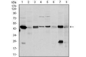 Western blot analysis using ASS1 mouse mAb against A431 (1), RAJI (2), MOLT4 (3), Jurkat (4), A549 (5), NIH/3T3 (6), PC-12 (7) and Cos7 (8) cell lysate. (ASS1 anticorps)