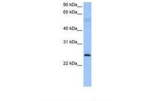 Image no. 1 for anti-Rhophilin Associated Tail Protein 1 (ROPN1) (AA 39-88) antibody (ABIN6738784) (ROPN1 anticorps  (AA 39-88))