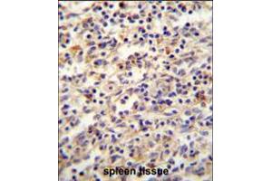 IGF2BP2 antibody immunohistochemistry analysis in formalin fixed and paraffin embedded human spleen tissue followed by peroxidase conjugation of the secondary antibody and DAB staining. (IGF2BP2 anticorps  (C-Term))