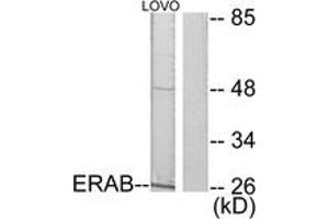 Western blot analysis of extracts from LOVO cells, using ERAB Antibody. (HSD17B10 anticorps  (AA 111-160))