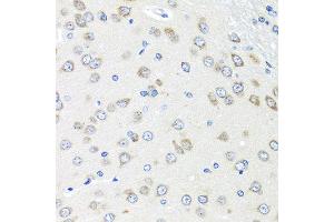 Immunohistochemistry of paraffin-embedded rat brain using PIAS3 antibody at dilution of 1:100 (40x lens). (PIAS3 anticorps)