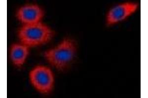 Immunofluorescent analysis of DOK1 staining in K562 cells. (DOK1 anticorps)