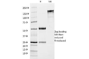 SDS-PAGE Analysis Purified Growth Hormone Monoclonal Antibody (SPM106).