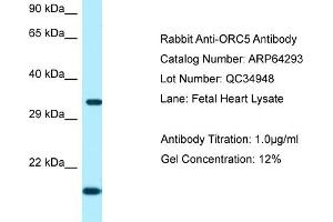 Western Blotting (WB) image for anti-Origin Recognition Complex, Subunit 5 (ORC5) (C-Term) antibody (ABIN2789793)