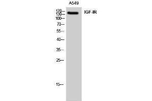 Western Blotting (WB) image for anti-Insulin-Like Growth Factor 1 Receptor (IGF1R) (Ser528) antibody (ABIN3185141) (IGF1R anticorps  (Ser528))