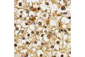 Immunohistochemical analysis of BMI1 staining in human kidney formalin fixed paraffin embedded tissue section.