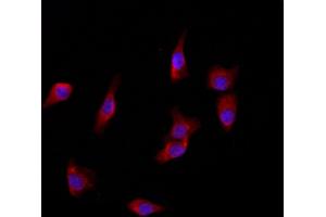 ABIN6266079 and ABIN6272868 staining HepG2 by IF/ICC. (YME1L1 anticorps  (C-Term))