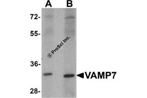 Western Blotting (WB) image for anti-Vesicle-Associated Membrane Protein 7 (VAMP7) antibody (ABIN1031804) (VAMP7 anticorps)