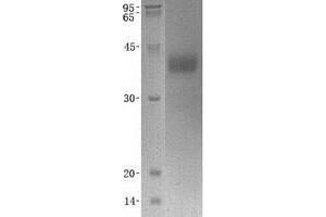 Validation with Western Blot