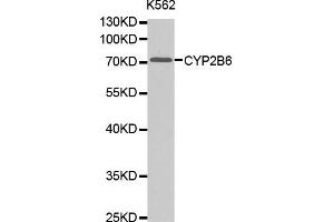 Western blot analysis of extracts of K562 cell lines, using CYP2B6 antibody.