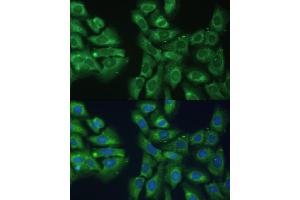 Immunofluorescence analysis of U-2 OS cells using EIF3D antibody (ABIN6130833, ABIN6140057, ABIN6140058 and ABIN6221638) at dilution of 1:100.