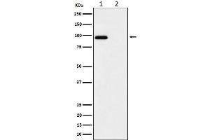 Western blot analysis of Phospho-FGFR3 (Y724) expression in (1) MCF7 treated with pervanadate cell lysate, (2) untreated.