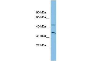 WB Suggested Anti-RHBG Antibody Titration: 0. (RHBG anticorps  (N-Term))