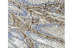 IHC analysis of ASAH1 using anti-ASAH1 antibody (ABIN7602206). (ASAH1 anticorps  (AA 63-393))