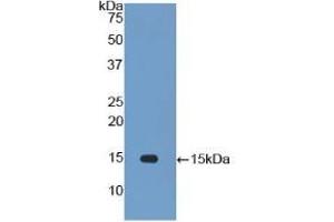Detection of Recombinant IL34, Rat using Polyclonal Antibody to Interleukin 34 (IL34)