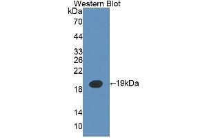 Detection of Recombinant IL3, Mouse using Polyclonal Antibody to Interleukin 3 (IL3) (IL-3 anticorps  (AA 33-166))