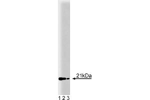 Western Blotting (WB) image for anti-Retinol Binding Protein 4, Plasma (RBP4) (AA 1-135) antibody (ABIN967847)