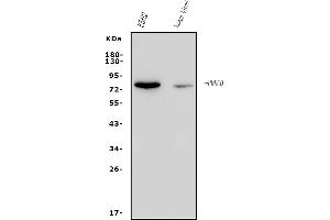 Western blot analysis of PKC Theta/PRKCQ using anti-PKC Theta/PRKCQ antibody (ABIN7600767).