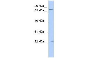 STRA6 antibody used at 1 ug/ml to detect target protein.