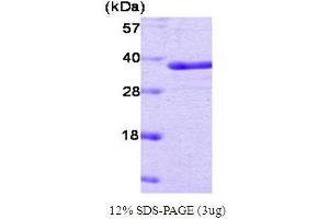 SDS-PAGE (SDS) image for Protein tyrosine Phosphatase, Non-Receptor Type 1 (PTPN1) protein (ABIN666832)