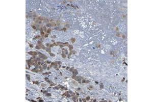 Immunohistochemical staining of human cerebellum with PCNT polyclonal antibody  shows strong cytoplasmmic positivity in Purkinje cells at 1:50-1:200 dilution. (PCNT anticorps)