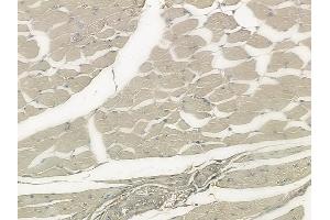 ABIN6265040 and ABIN6273317 at 1/100 staining human tongue carcinoma by IHC-P.