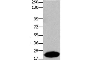 Western Blot analysis of Human liver cancer tissue using Claudin 7 Polyclonal Antibody at dilution of 1:1050 (Claudin 7 anticorps)