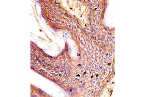 (ABIN659120 and ABIN2843760) staining CD44 in human skin tissue sections by Immunohistochemistry (IHC-P - paraformaldehyde-fixed, paraffin-embedded sections). (CD44 anticorps)