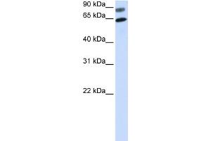 WB Suggested Anti-DVL2 Antibody Titration:  0. (DVL2 anticorps  (N-Term))