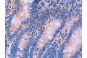 Used in DAB staining on fromalin fixed paraffin- embedded testis tissue