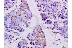 Formalin-fixed and paraffin embedded rat pancreas labeled with Anti-SGCB/SGC Polyclonal Antibody, Unconjugated (ABIN738051) at 1:200 followed by conjugation to the secondary antibody and DAB staining. (SGCB anticorps  (AA 165-260))