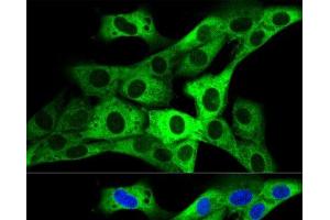 Confocal immunofluorescence analysis of NIH-3T3 cells using GARS Polyclonal Antibody at dilution of 1:200.