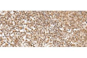 Immunohistochemistry of paraffin-embedded Human tonsil tissue using ZNF354A Polyclonal Antibody at dilution of 1:40(x200) (ZNF354A anticorps)