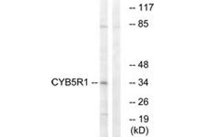 Western blot analysis of extracts from RAW264. (CYB5R1 anticorps  (AA 9-58))