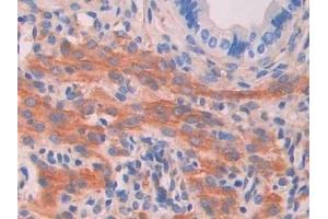 Detection of MYLK in Mouse Uterus Tissue using Polyclonal Antibody to Myosin Light Chain Kinase (MYLK) (MYLK anticorps  (AA 1684-1884))