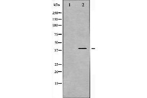 Western blot analysis of MKK3 phosphorylation expression in MDA-MB-435 whole cell lysates,The lane on the left is treated with the antigen-specific peptide.