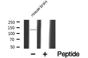 Western blot analysis of extracts from mouse brain , using DGKD antibody.