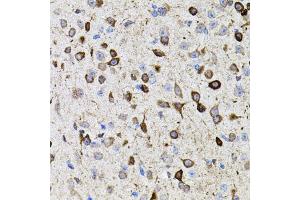 Immunohistochemistry of paraffin-embedded mouse brain using MMP9 antibody (ABIN4904400) at dilution of 1:100 (40x lens). (MMP 9 anticorps)