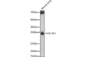 Western blot analysis of extracts of Mouse lung, using H2-Ab1 antibody (ABIN7267665) at 1:1000 dilution. (H2-AB1 anticorps)