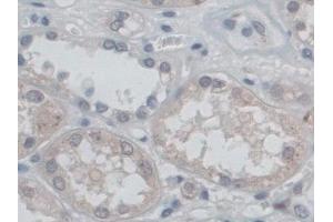 Detection of CD209 in Human Kidney Tissue using Polyclonal Antibody to Cluster Of Differentiation 209 (CD209)