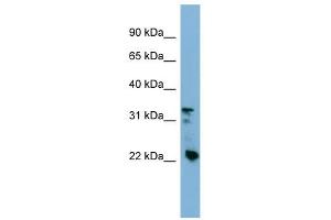 Western Blot showing Crystallin Beta B3 antibody used at a concentration of 1-2 ug/ml to detect its target protein.